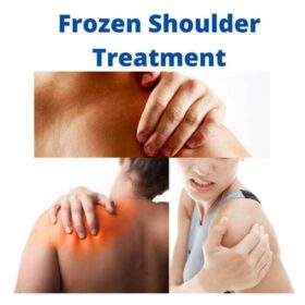 Frozen Shoulder Treatment