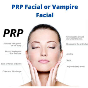 PRP Facial or Vampire Facial