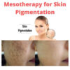 Mesotherapy for Skin Pigmentation