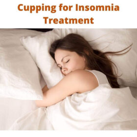 Cupping for Insomnia Treatment