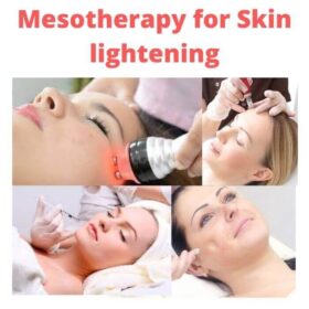 mesotherapy for skin lightening