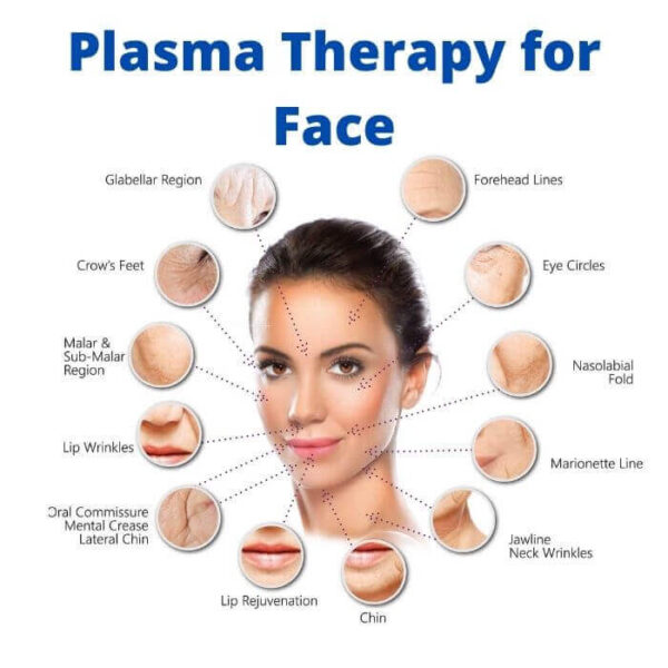 Plasma Therapy for Face