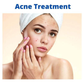 acne treatment