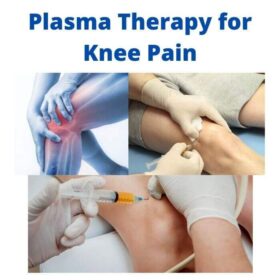 Plasma Therapy for Knee Pain