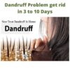 Dandruff Problem get rid in 3 to 10 Days
