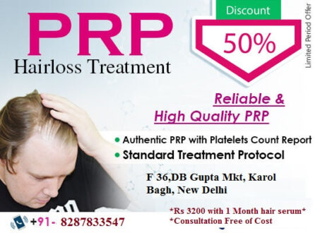 Best Cost of PRP in Delhi for treating Hair Fall/Loss