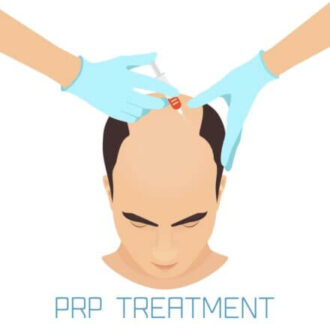 PRP treatment for hair loss: unlock the doors of a confident and happier life !