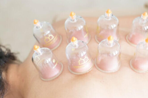 Cupping Therapy: What It Is, Uses & Benefits