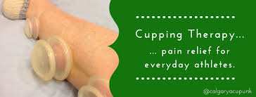Cupping Therapy Relieves Pain and Promotes Healing