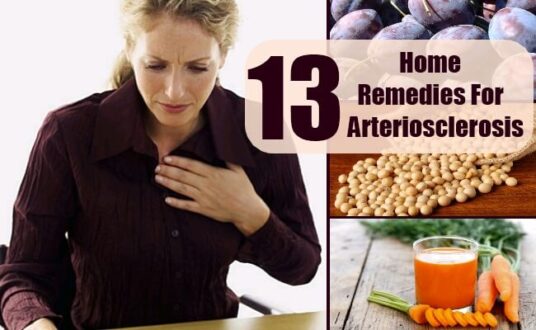 HOME REMEDIES FOR ARTERIOSCLEROSIS