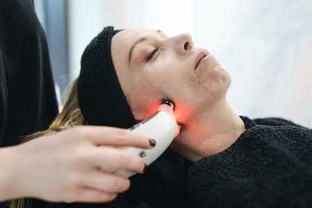 Laser Treatment for Skin Brightening and Pigmentation Removal